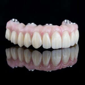 Completas implantosoportables